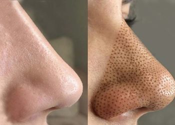 آر اف ترماژ در مشهد