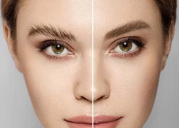 بهترین کلینیک کاشت ابرو در تهران