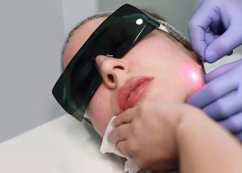 مدت زمان ماندگاری لیزر اندولیفت