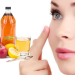 خواص سرکه سیب برای سلامتی، پوست و مو