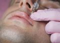 آقایان هم می توانند از خدمات تزریق ژل لب مردانه استفاده کنند؟