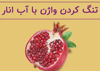 کدام روش تنگ کردن واژن بهتر است؟ جراحی یا درمان های خانگی