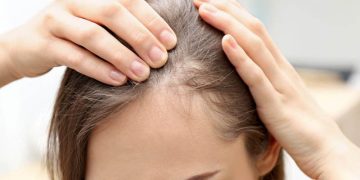 بهترین دکتر ریزش مو در رشت