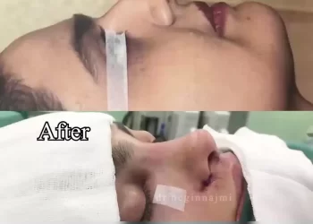 بهترین جراح بینی در رشت