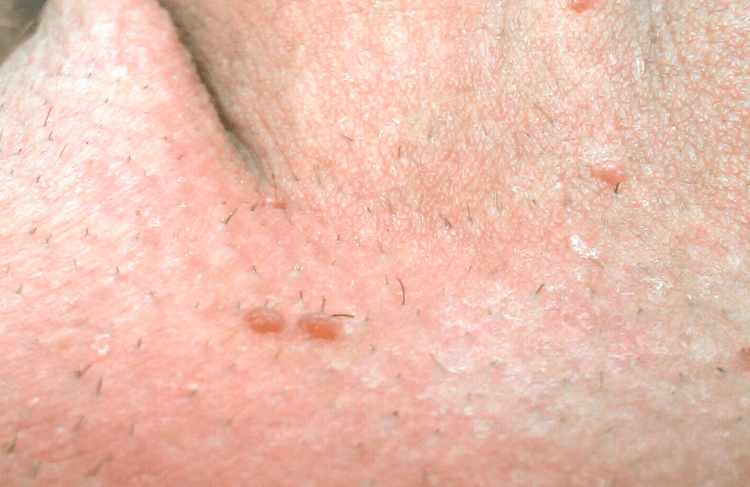 10 تا از بهترین دکتر زگیل تناسلی در الهیه